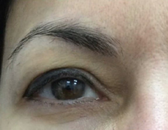 Before Image